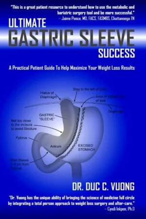 Ultimate Gastric Sleeve Success: A Practical Patient Guide To Help Maximize Your Weight Loss Results Paperback  June 21, 2013