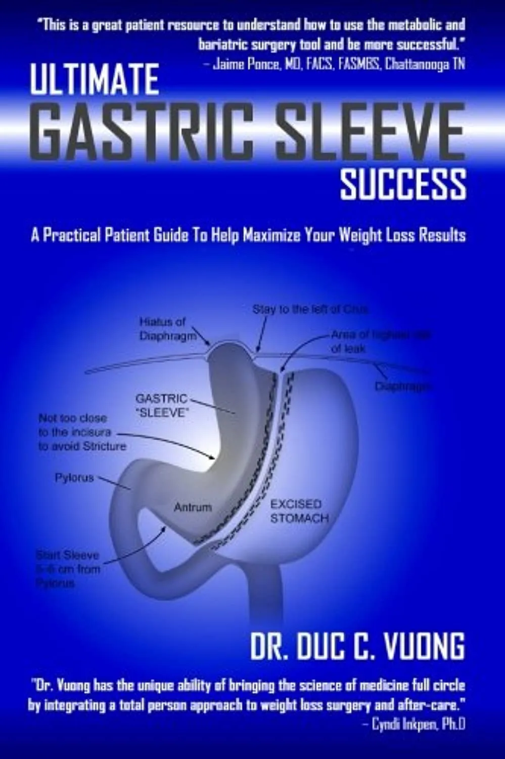 Ultimate Gastric Sleeve Success: A Practical Patient Guide To Help Maximize Your Weight Loss Results Paperback  June 21, 2013